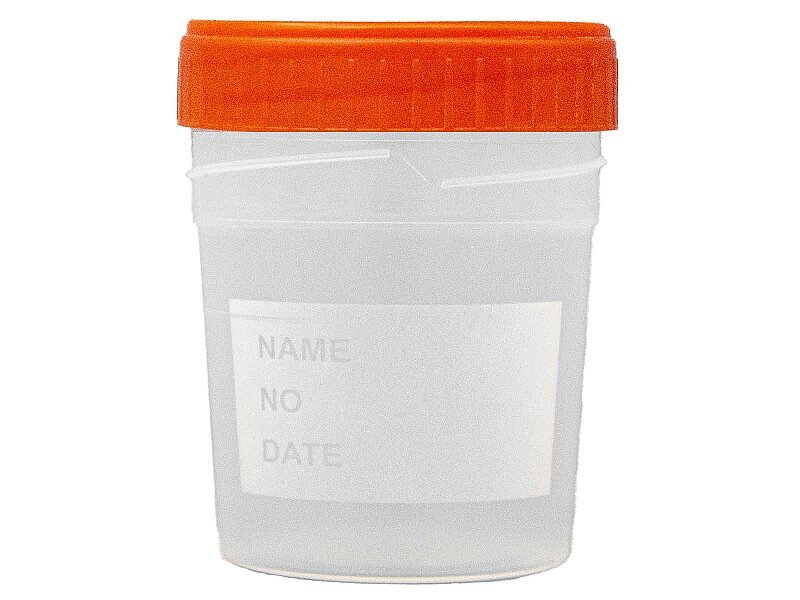 Numune Beheri Steril 100 ML 25 ADET - 4