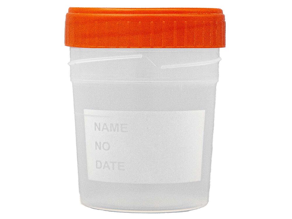 Numune Beheri Steril 100 ML 25 ADET - 4